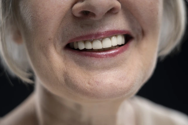 Senhora sorrindo após realizar uma reabilitação oral.