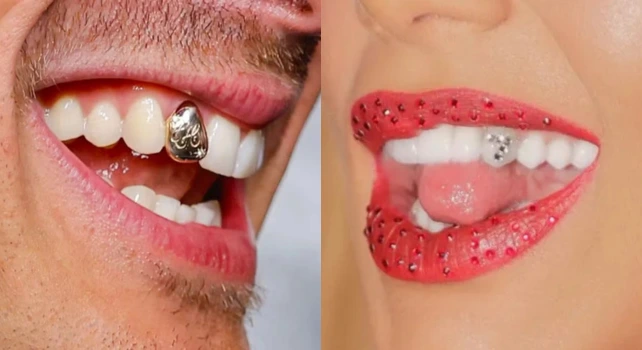 Joias dentais nos sorrisos de Jacob Elordi e Virginia Fonseca.