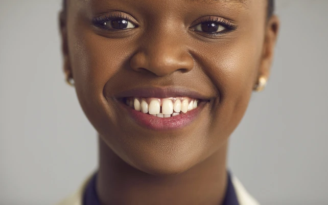 Mulher negra sorrindo e mostrando o diastema.