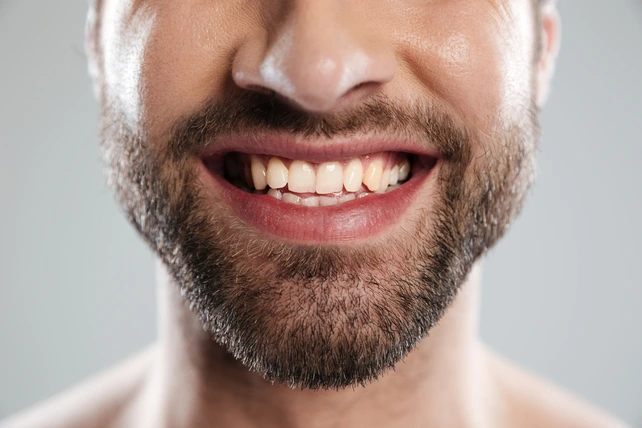 Homem branco sorrindo com close nos dentes.